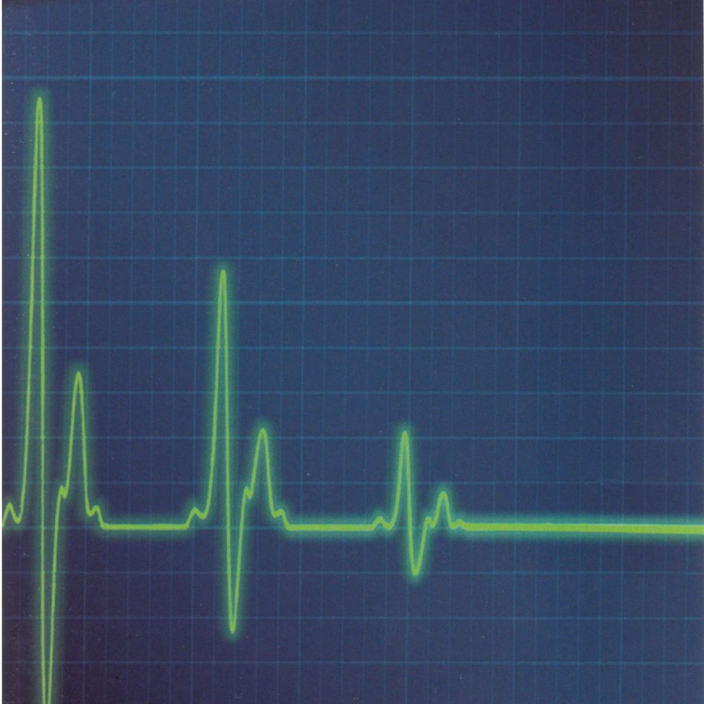 What happens when I die
